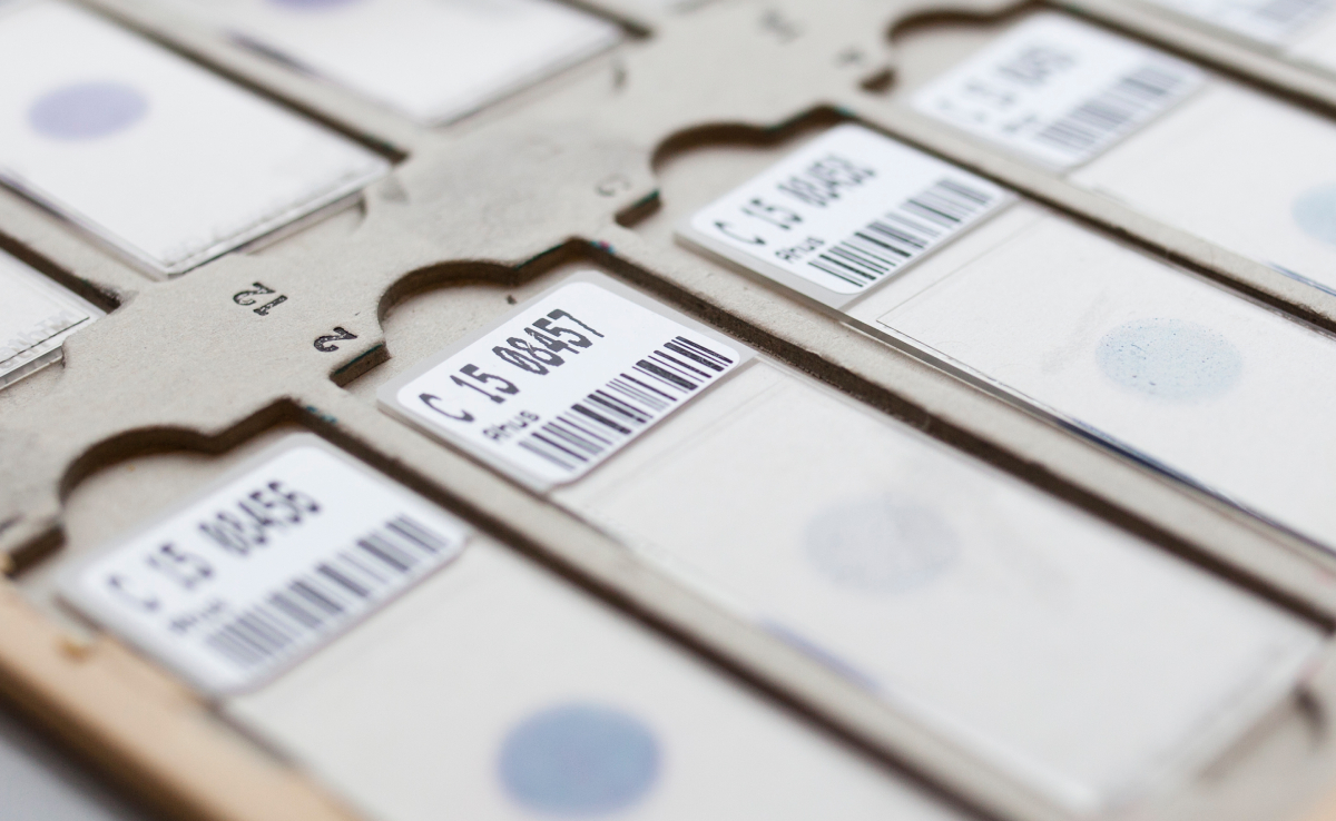 Bildet viser en nærstudie av flere objektglass som brukes i laboratorier, spesielt innen patologi.