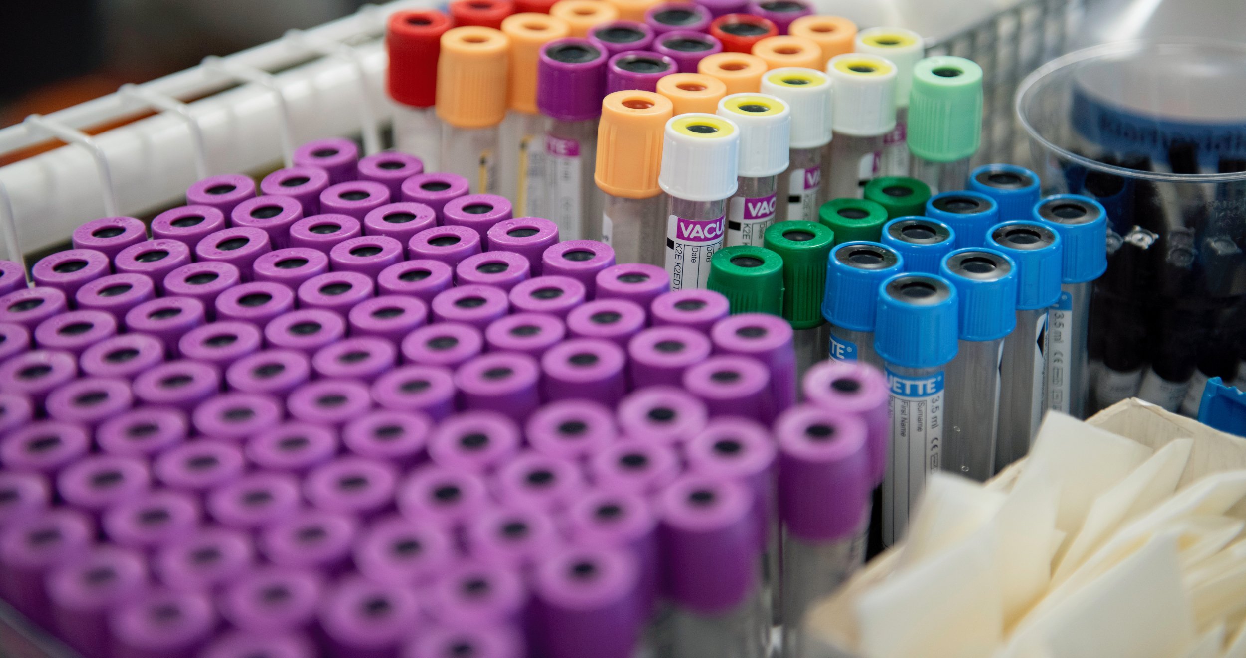 Fargerike blodprøverør i stativ: lilla, oransje, grønne og blå, klare til bruk i laboratorieanalyse.